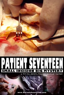Patient Seventeen (2015) cover